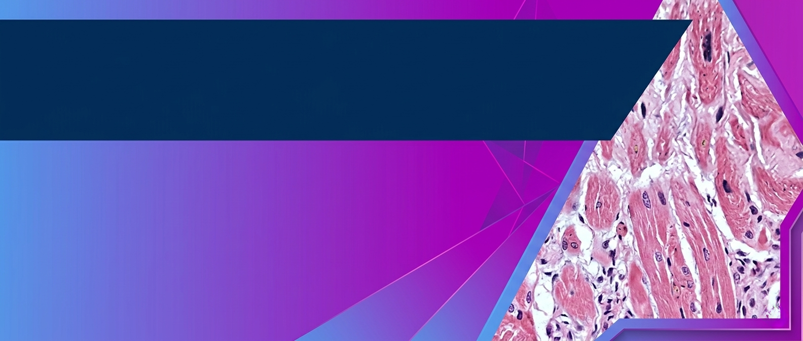 Cardiac Amyloidosis: Accelerating Diagnosis and Treatment