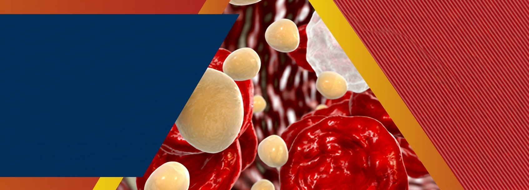 Familial Hypercholesterolemia